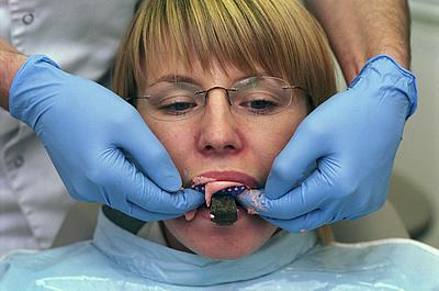 Dentist applying mould